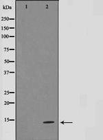 Gastrin Antibody in Western Blot (WB)