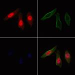 SPDL1 Antibody in Immunocytochemistry (ICC/IF)