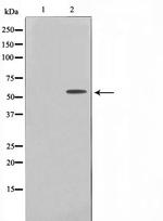 TBX22 Antibody in Western Blot (WB)