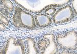 ELOVL1 Antibody in Immunohistochemistry (Paraffin) (IHC (P))