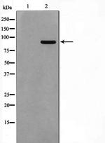 AAK1 Antibody in Western Blot (WB)