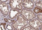 FAP Antibody in Immunohistochemistry (Paraffin) (IHC (P))