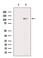 FAP Antibody in Western Blot (WB)