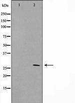 KDELR3 Antibody in Western Blot (WB)