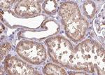 MRRF Antibody in Immunohistochemistry (Paraffin) (IHC (P))