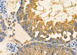 MRRF Antibody in Immunohistochemistry (Paraffin) (IHC (P))