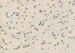 CtBP1 Antibody in Immunohistochemistry (Paraffin) (IHC (P))