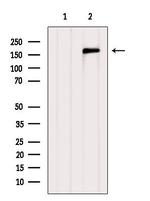 MEKK4 Antibody in Western Blot (WB)