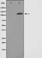 SUPT16H Antibody in Western Blot (WB)