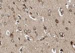 Phospho-NMDAR1 (Ser897) Antibody in Immunohistochemistry (Paraffin) (IHC (P))