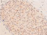 Acetyl-p53 (Lys319) Antibody in Immunohistochemistry (Paraffin) (IHC (P))