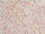 Acetyl-p53 (Lys319) Antibody in Immunohistochemistry (Paraffin) (IHC (P))