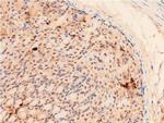 Acetyl-p53 (Lys319) Antibody in Immunohistochemistry (Paraffin) (IHC (P))