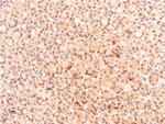 Acetyl-p53 (Lys319) Antibody in Immunohistochemistry (Paraffin) (IHC (P))