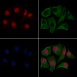 Phospho-Glucocorticoid Receptor (Ser211) Antibody in Immunocytochemistry (ICC/IF)