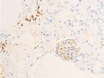 Phospho-Glucocorticoid Receptor (Ser211) Antibody in Immunohistochemistry (Paraffin) (IHC (P))