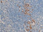 Phospho-Glucocorticoid Receptor (Ser211) Antibody in Immunohistochemistry (Paraffin) (IHC (P))