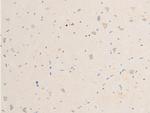 Phospho-SYK (Tyr323) Antibody in Immunohistochemistry (Paraffin) (IHC (P))