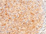 Phospho-Chk1 (Ser280) Antibody in Immunohistochemistry (Paraffin) (IHC (P))