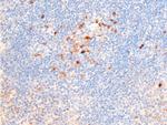 Phospho-Chk1 (Ser317) Antibody in Immunohistochemistry (Paraffin) (IHC (P))