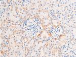 Phospho-Chk1 (Ser317) Antibody in Immunohistochemistry (Paraffin) (IHC (P))