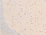 Phospho-Chk1 (Ser317) Antibody in Immunohistochemistry (Paraffin) (IHC (P))