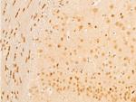 Phospho-TAK1 (Thr187) Antibody in Immunohistochemistry (Paraffin) (IHC (P))