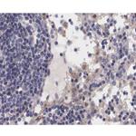 Phospho-JAK2 (Tyr1007) Antibody in Immunohistochemistry (Paraffin) (IHC (P))