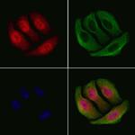 Phospho-Chk2 (Ser516) Antibody in Immunocytochemistry (ICC/IF)