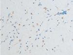 Phospho-Chk2 (Ser516) Antibody in Immunohistochemistry (Paraffin) (IHC (P))