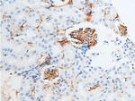 Phospho-Chk2 (Ser516) Antibody in Immunohistochemistry (Paraffin) (IHC (P))