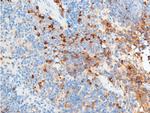 Phospho-Chk2 (Ser516) Antibody in Immunohistochemistry (Paraffin) (IHC (P))