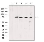 Phospho-Chk2 (Ser516) Antibody in Western Blot (WB)