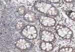 Phospho-ABL1/ABL2 (Tyr393) Antibody in Immunohistochemistry (Paraffin) (IHC (P))