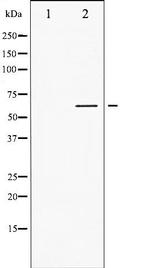 Phospho-LCK (Tyr505) Antibody in Western Blot (WB)