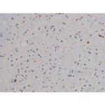 Phospho-Lyn (Tyr508) Antibody in Immunohistochemistry (Paraffin) (IHC (P))