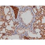 Phospho-Lyn (Tyr508) Antibody in Immunohistochemistry (Paraffin) (IHC (P))