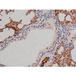 Phospho-Lyn (Tyr508) Antibody in Immunohistochemistry (Paraffin) (IHC (P))