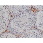 Phospho-Lyn (Tyr508) Antibody in Immunohistochemistry (Paraffin) (IHC (P))