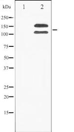 Phospho-FGFR1 (Tyr154) Antibody in Western Blot (WB)