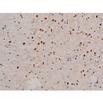 Phospho-GATA1 (Ser142) Antibody in Immunohistochemistry (Paraffin) (IHC (P))