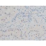 Phospho-GATA1 (Ser142) Antibody in Immunohistochemistry (Paraffin) (IHC (P))