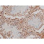 Phospho-GATA1 (Ser142) Antibody in Immunohistochemistry (Paraffin) (IHC (P))