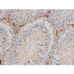 Phospho-Cdc25A (Ser124) Antibody in Immunohistochemistry (Paraffin) (IHC (P))