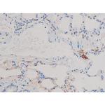 Phospho-Cdc25A (Ser124) Antibody in Immunohistochemistry (Paraffin) (IHC (P))