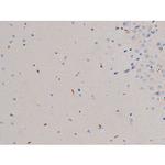 Phospho-CDC25A (Thr507) Antibody in Immunohistochemistry (Paraffin) (IHC (P))