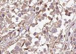 Phospho-p21 (Thr145) Antibody in Immunohistochemistry (Paraffin) (IHC (P))