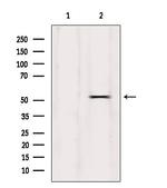 Phospho-GSK3 alpha (Ser21) Antibody in Western Blot (WB)