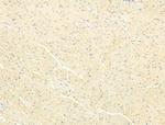 Phospho-SMAD2/SMAD3 (Thr8) Antibody in Immunohistochemistry (Paraffin) (IHC (P))