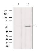Phospho-MEF2A (Thr319) Antibody in Western Blot (WB)